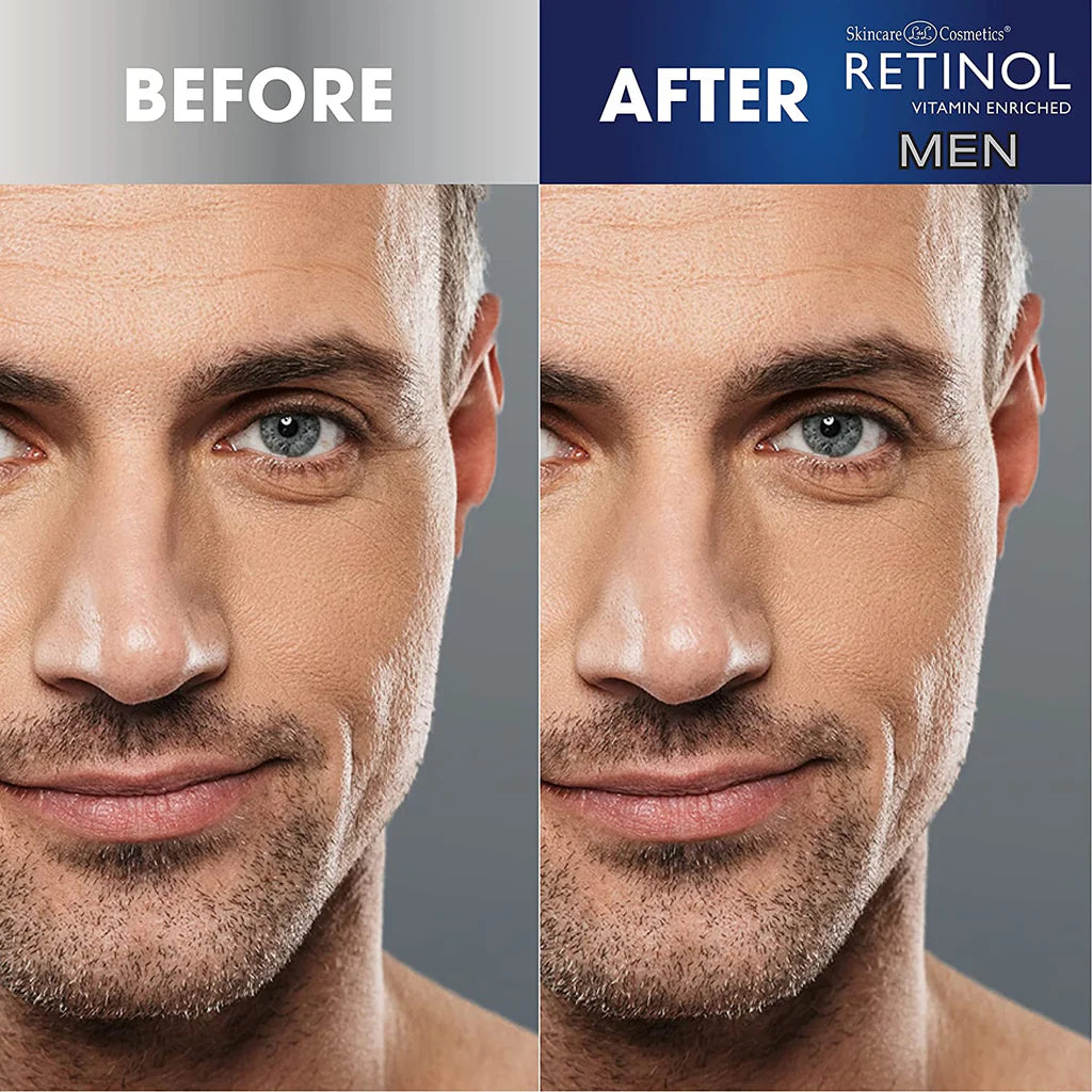 Retinol Men Pore-Clearing Strips